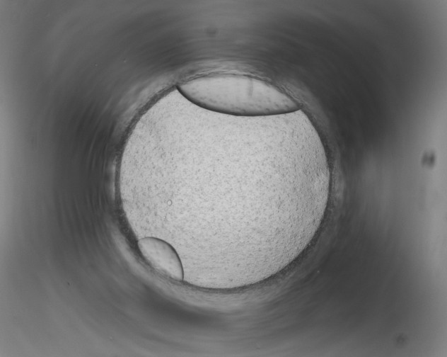 X0000116150014201001041103