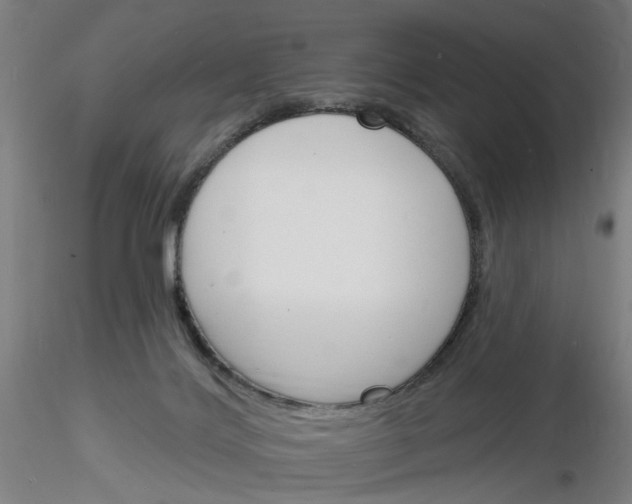 X0000116150028201001041103