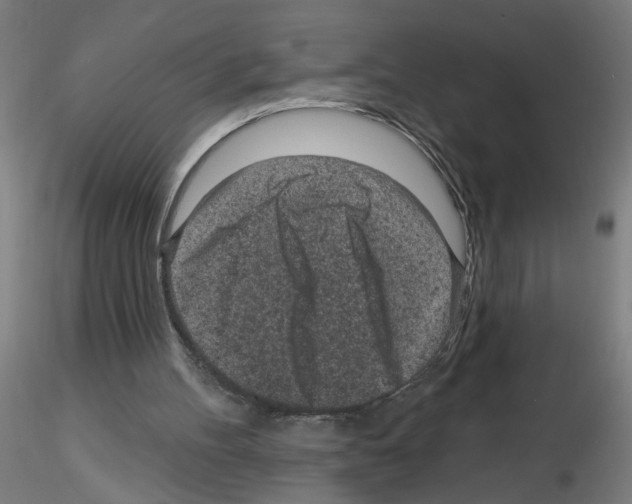 X0000116150100201001041102