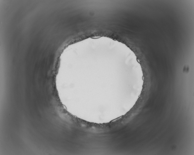 X0000116150144201001041101