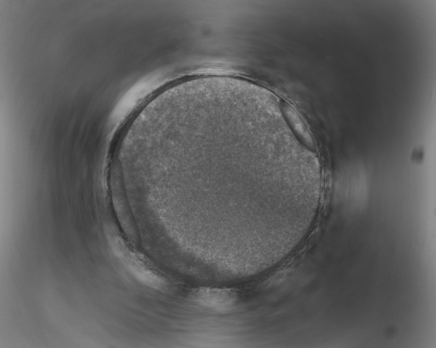 X0000116150296201001041059