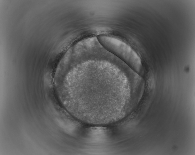 X0000116150316201001041059