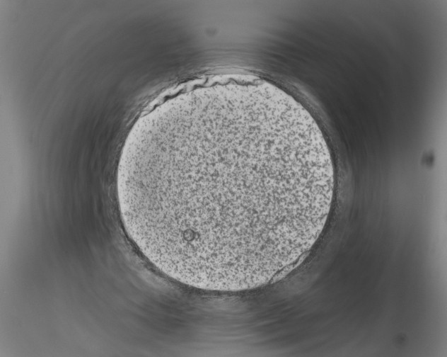 X0000116150385201001041058