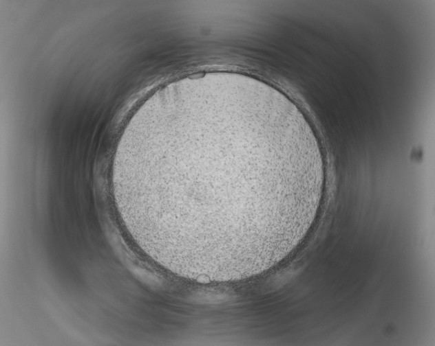 X0000116150386201001041058