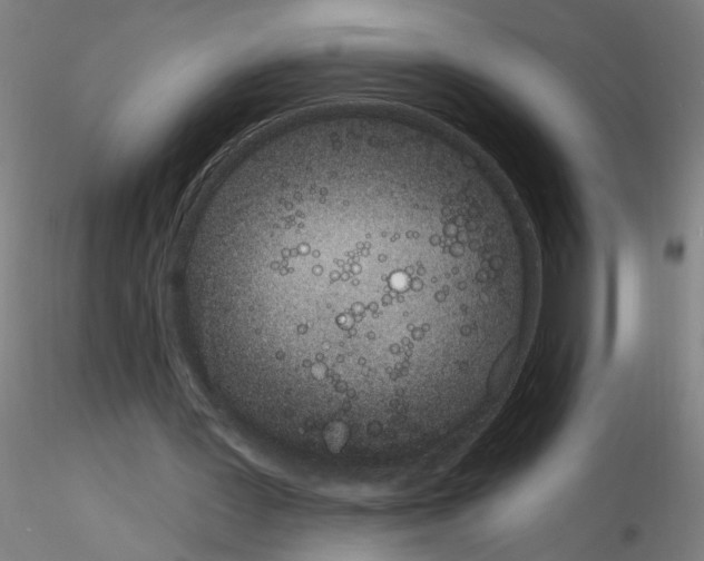 X0000116150387201001041058