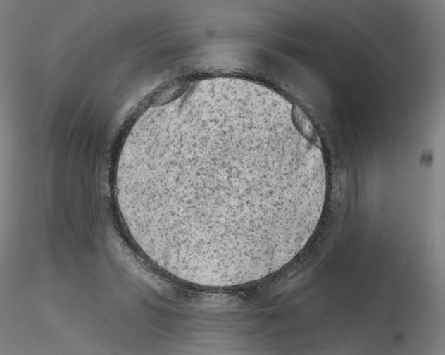 X0000116150399201001041057