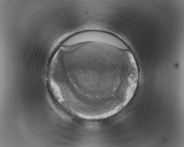 X0000116150438201001041056