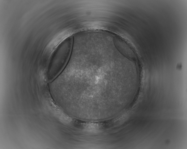 X0000116150785201001041052