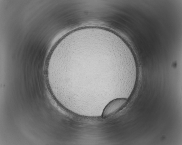 X0000116150990201001041049