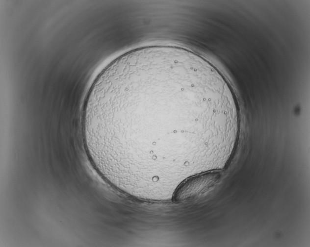 X0000116151004201001041049