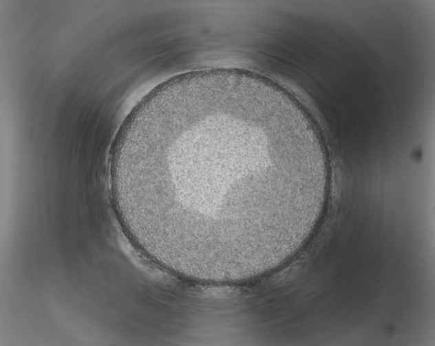 X0000116151031201001041049