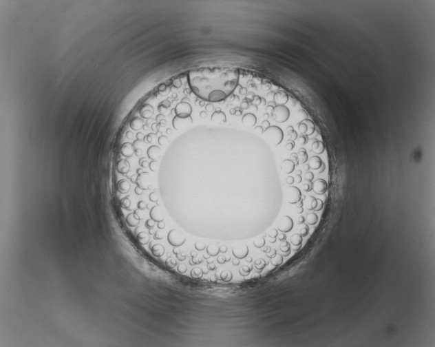 X0000116151130201001041048