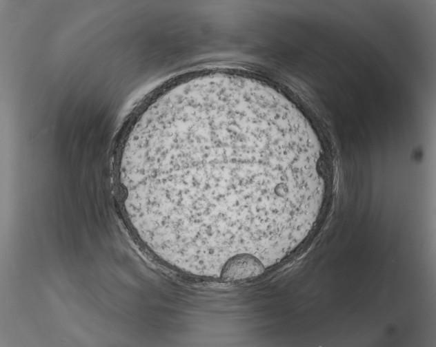 X0000116151164201001041047