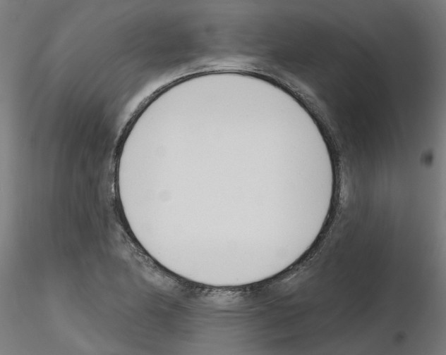 X0000116151174201001041047