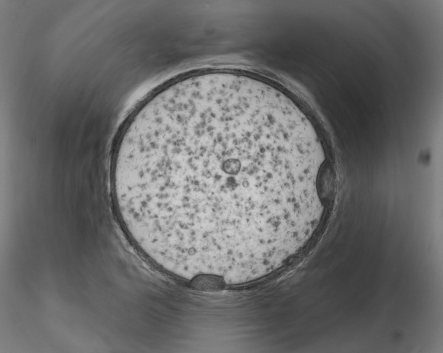 X0000116151176201001041047