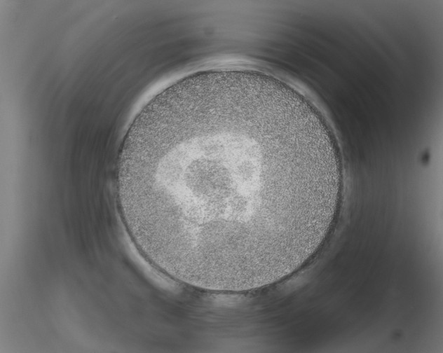 X0000116151429201001041044