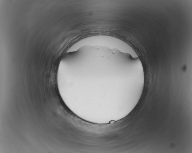 X0000116160035201001041123