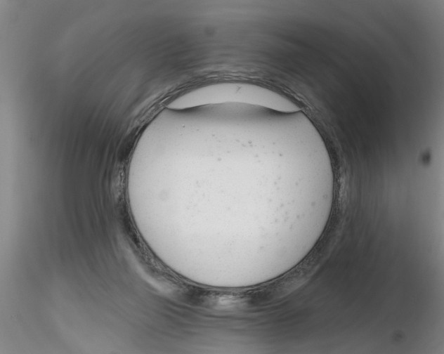X0000116160165201001041121