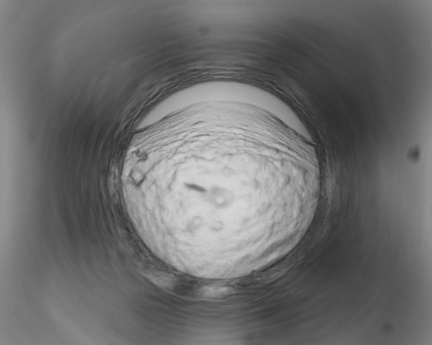 X0000116160169201001041122