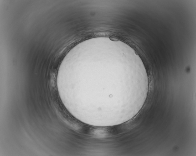 X0000116160171201001041122