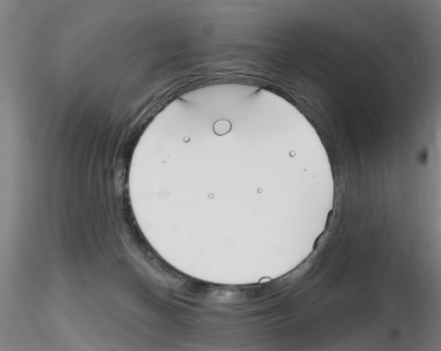 X0000116160174201001041122