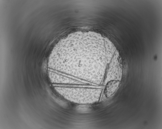 X0000116160179201001041122