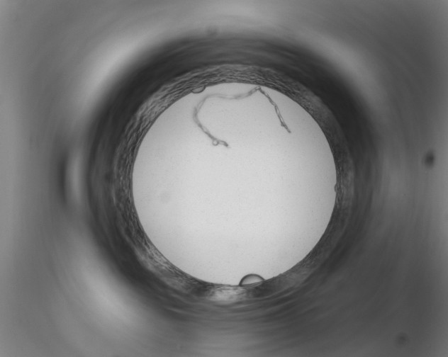 X0000116160189201001041122