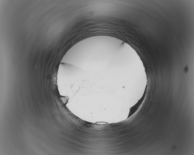 X0000116160190201001041122
