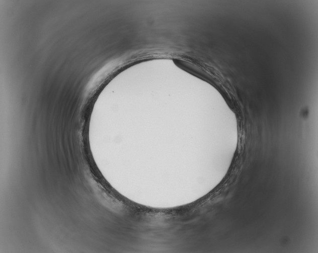 X0000116160197201001041121