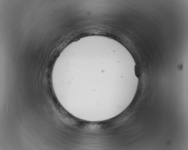 X0000116160217201001041121