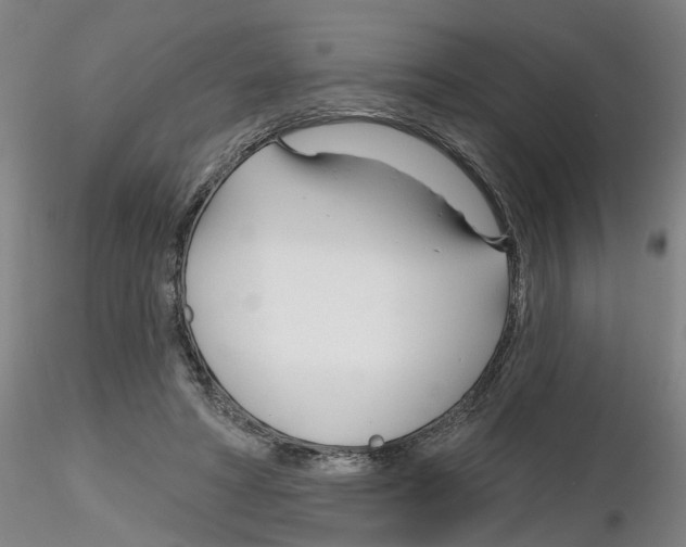 X0000116160402201001041118