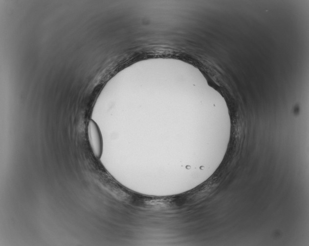 X0000116160516201001041117