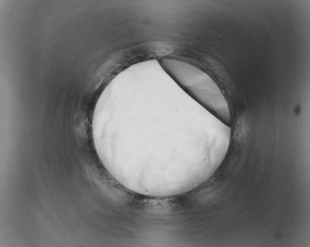 X0000116160524201001041117