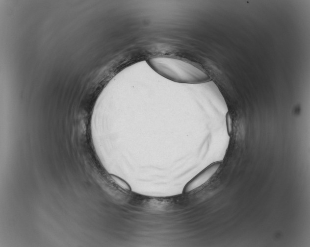 X0000116160570201001041117