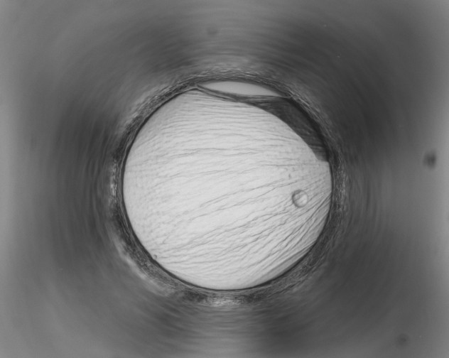 X0000116160590201001041116