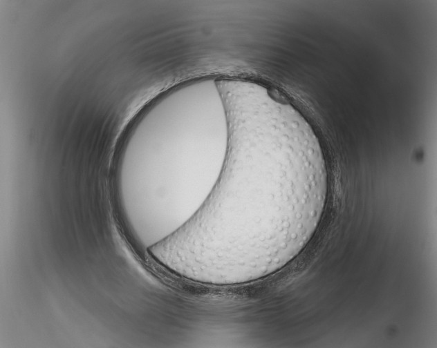 X0000116160630201001041115