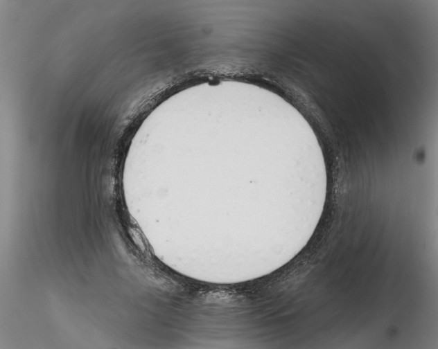 X0000116160635201001041115