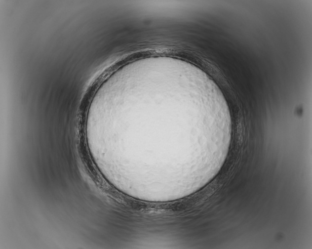 X0000116160730201001041114