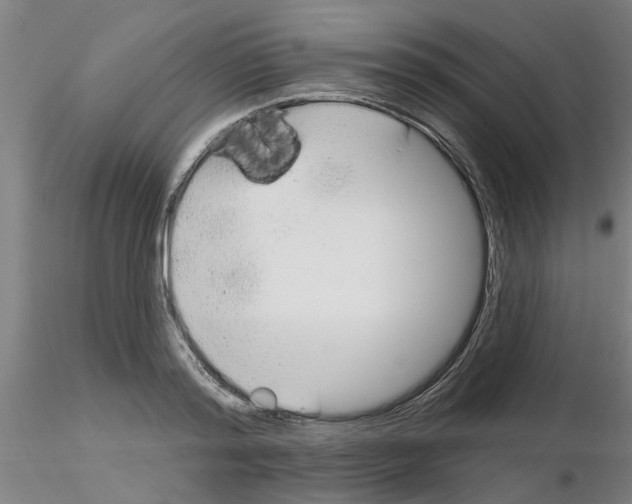 X0000116160796201001041113