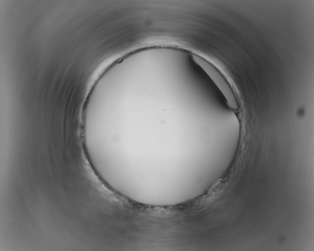 X0000116160815201001041113