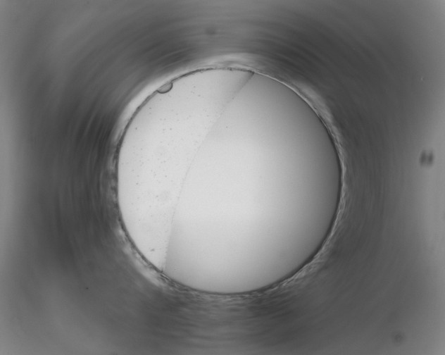 X0000116160816201001041113