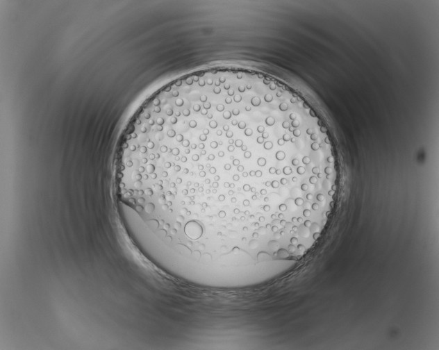 X0000116160955201001041111