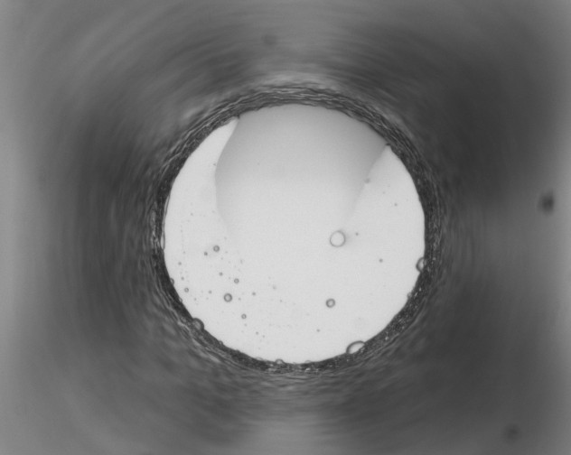 X0000116160965201001041111
