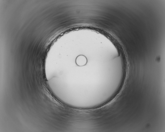 X0000116160969201001041111