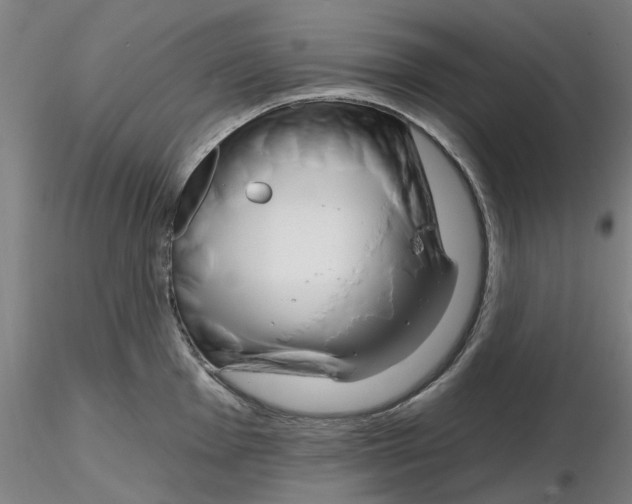 X0000116161001201001041110