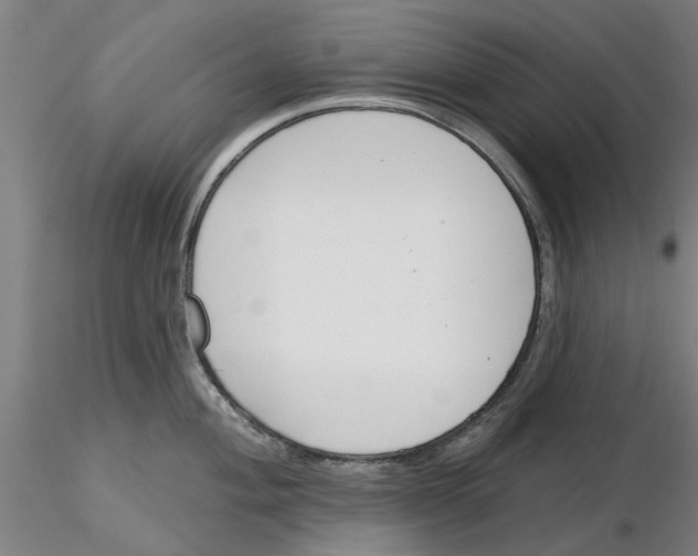 X0000116161004201001041110
