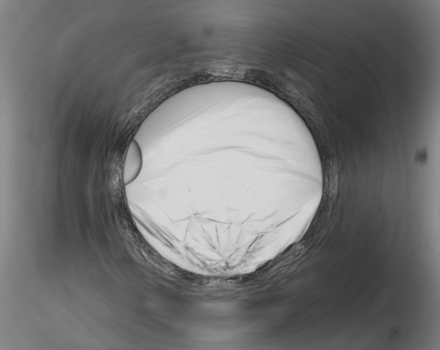 X0000116161154201001041108