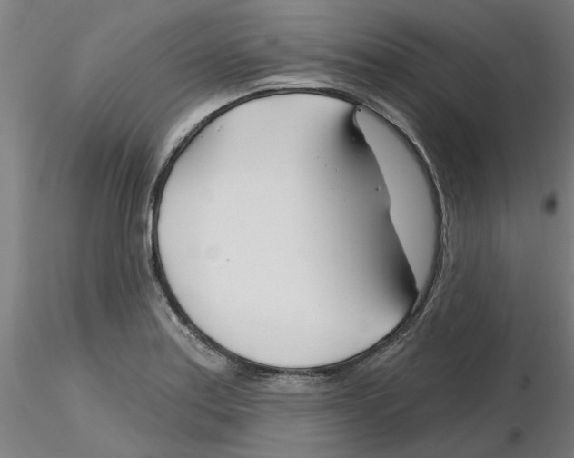 X0000116161179201001041108