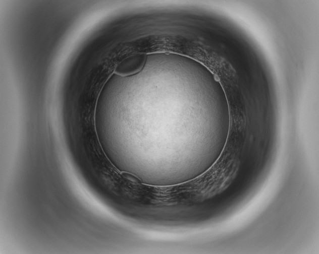 X0000116260766200911301153