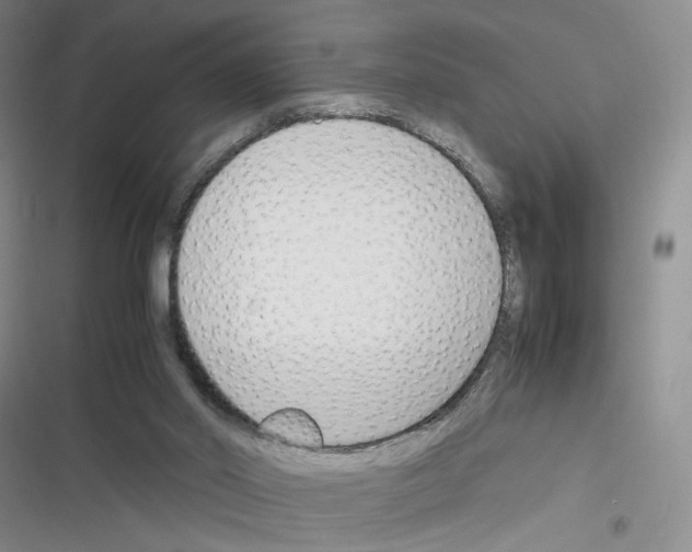 X0000116260014201001111003